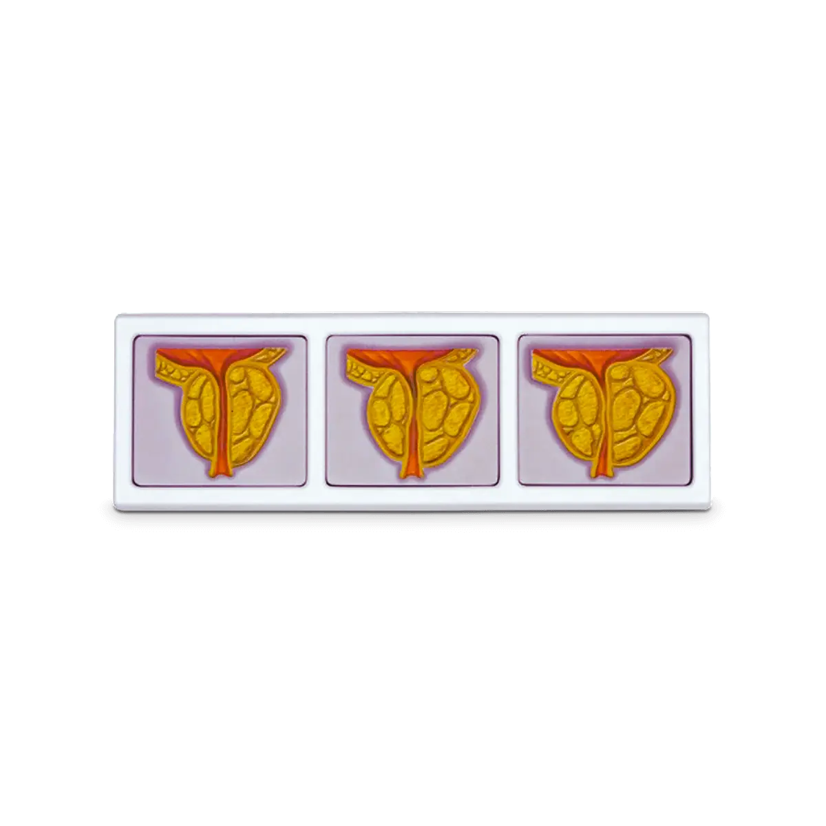 3D Male Pelvis and Prostate Model