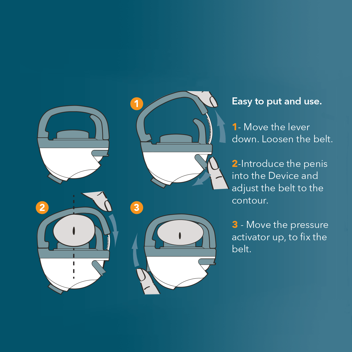 Harex Urinary Incontinence Medical Device image 3