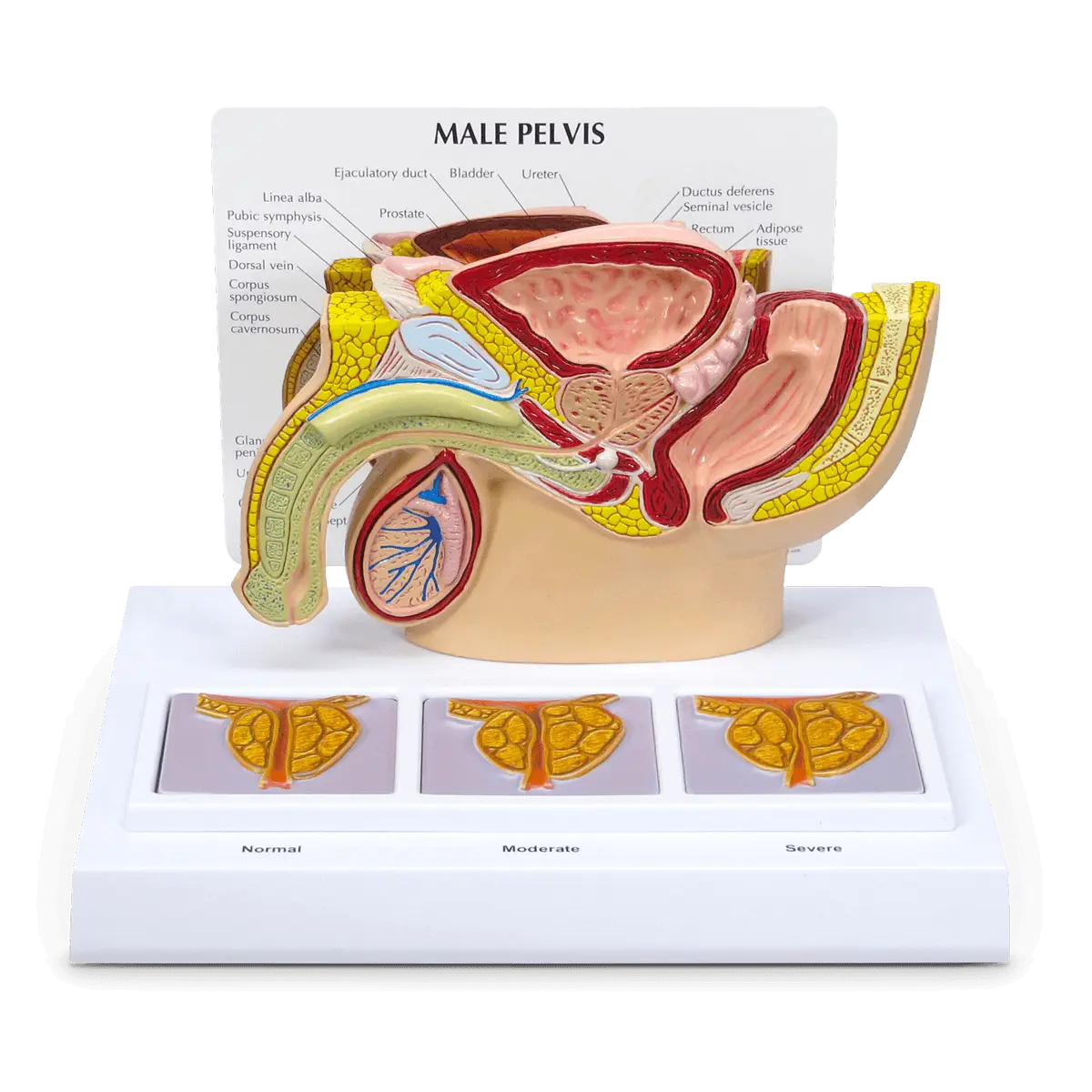 3D Male Pelvis and Prostate Model