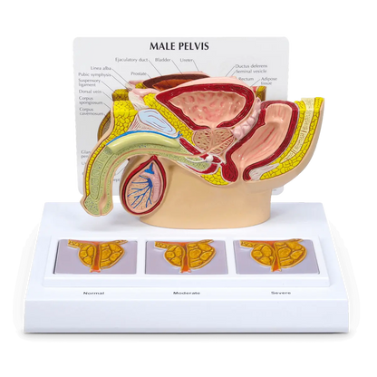 3D Male Pelvis and Prostate Model