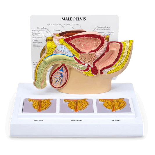 3D Male Pelvis and Prostate Model