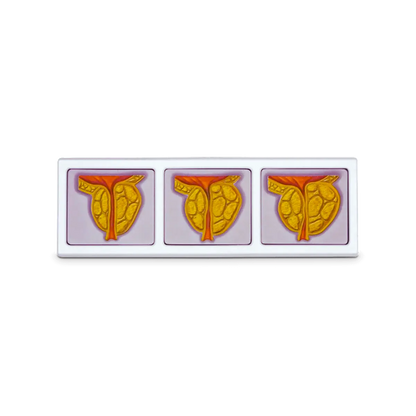 3D Male Pelvis and Prostate Model