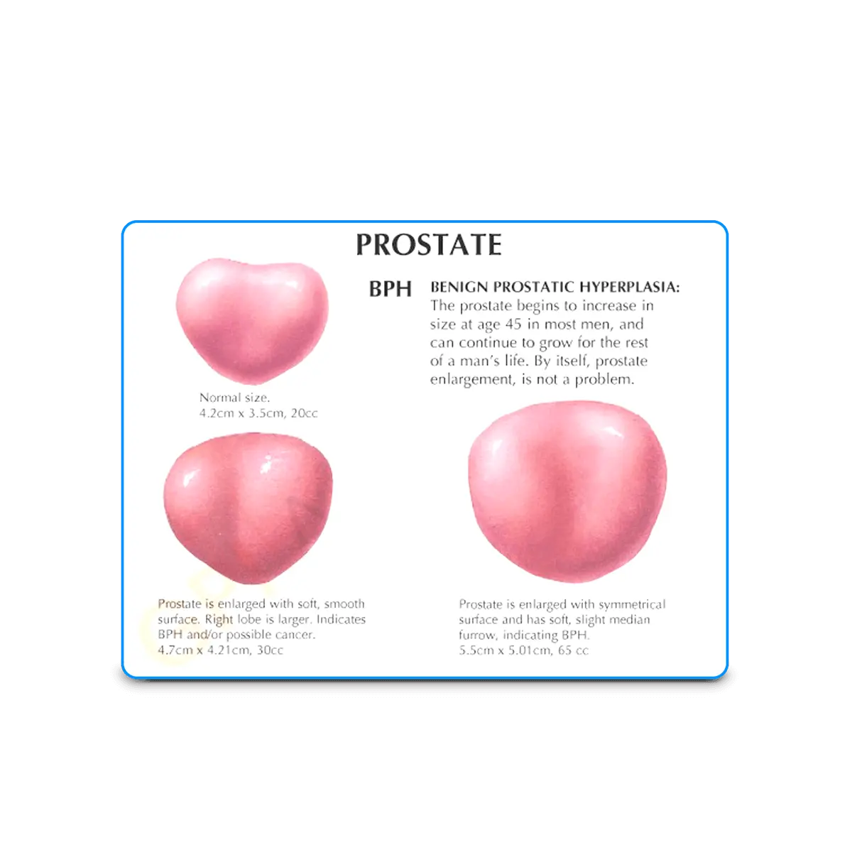 3D Male Pelvis and Prostate Model