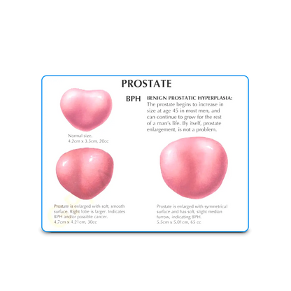 3D Male Pelvis and Prostate Model